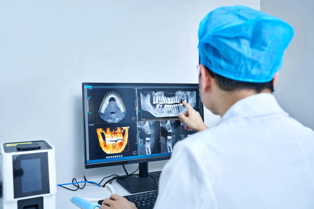 Best Emergency Tooth Extraction in Hartville, OH