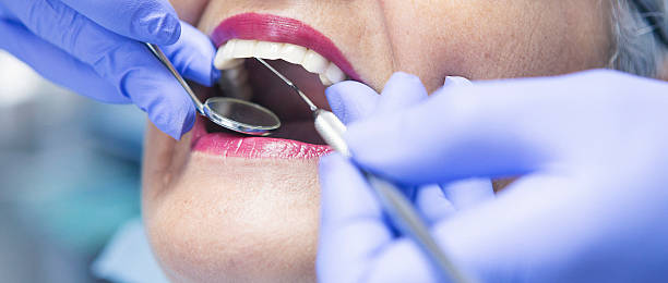 Best Emergency Treatment for Toothache in Hartville, OH